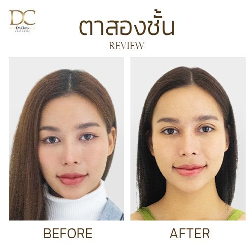 ทำตาสองชั้น