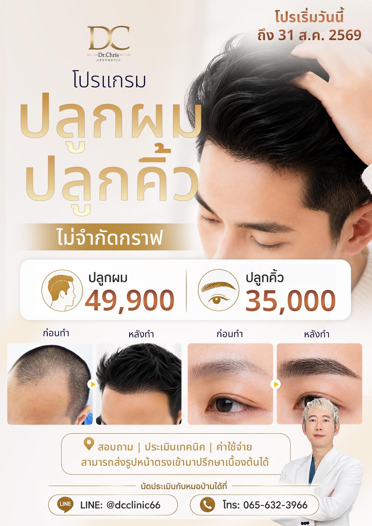 เสริมจมูก ลดราคาพิเศษ