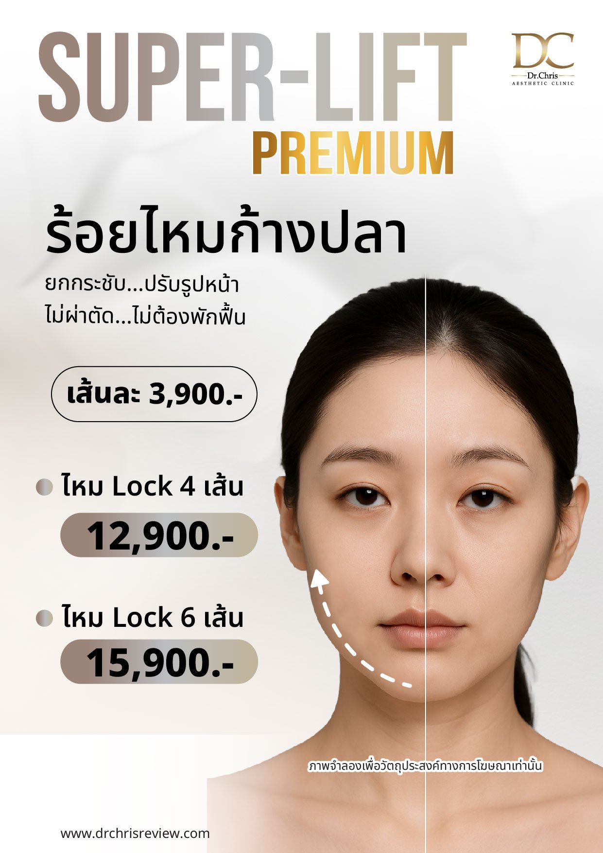 IV Therapy ซื้อ 5 ฟรี 1