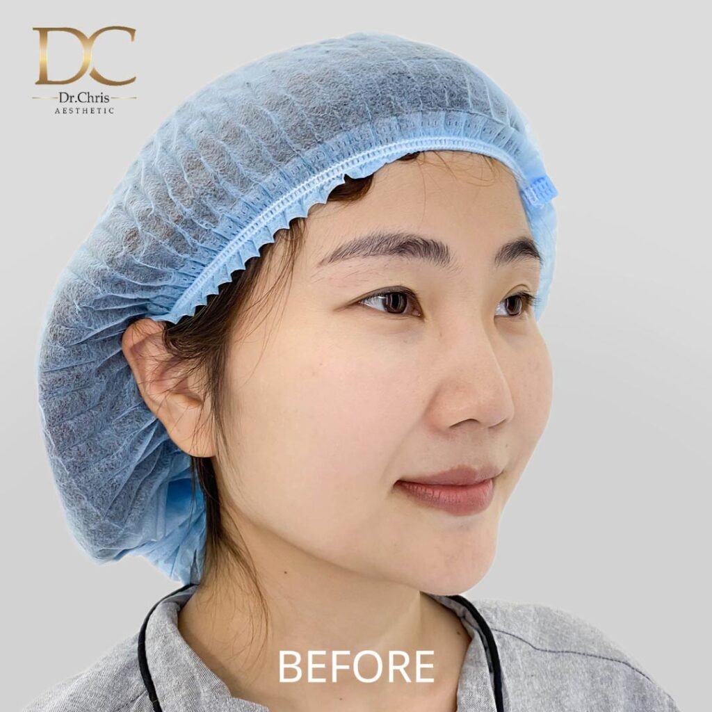 Before/After