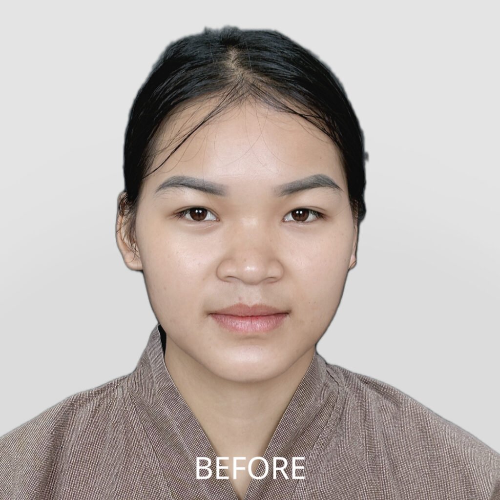 Before/After
