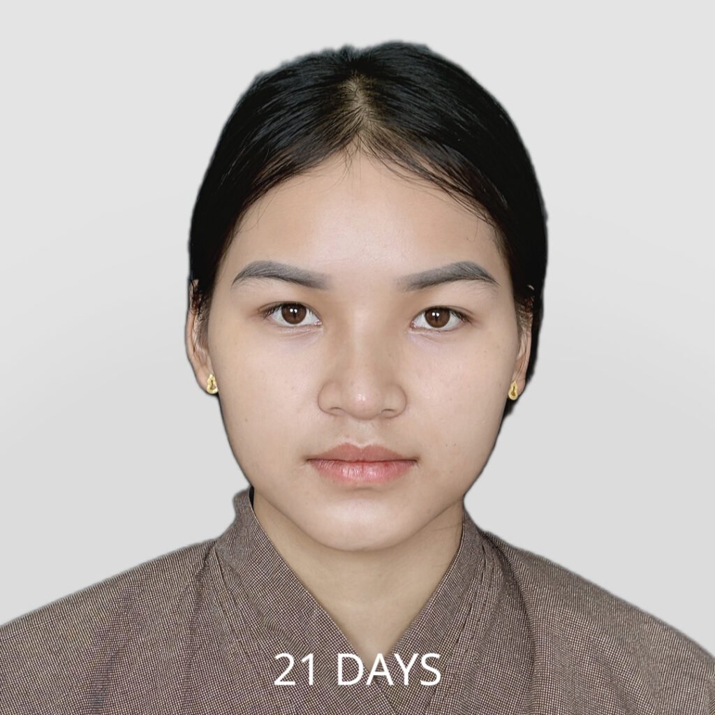 Before/After
