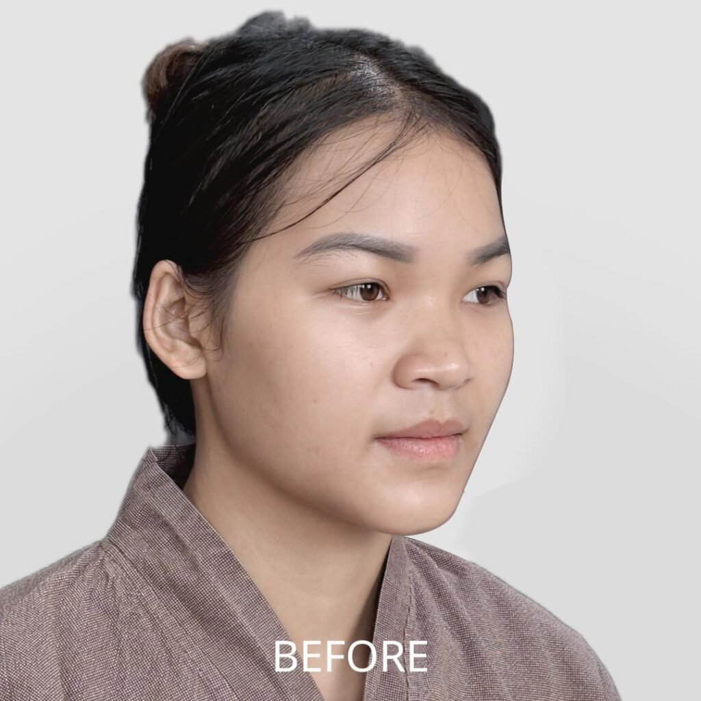 Before/After