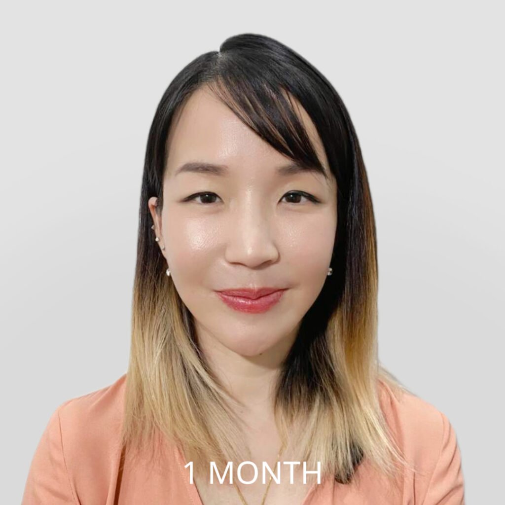 Before/After