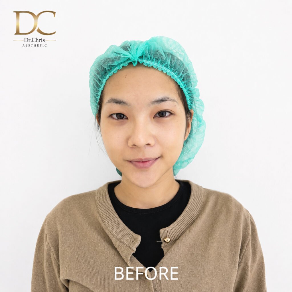 Before/After