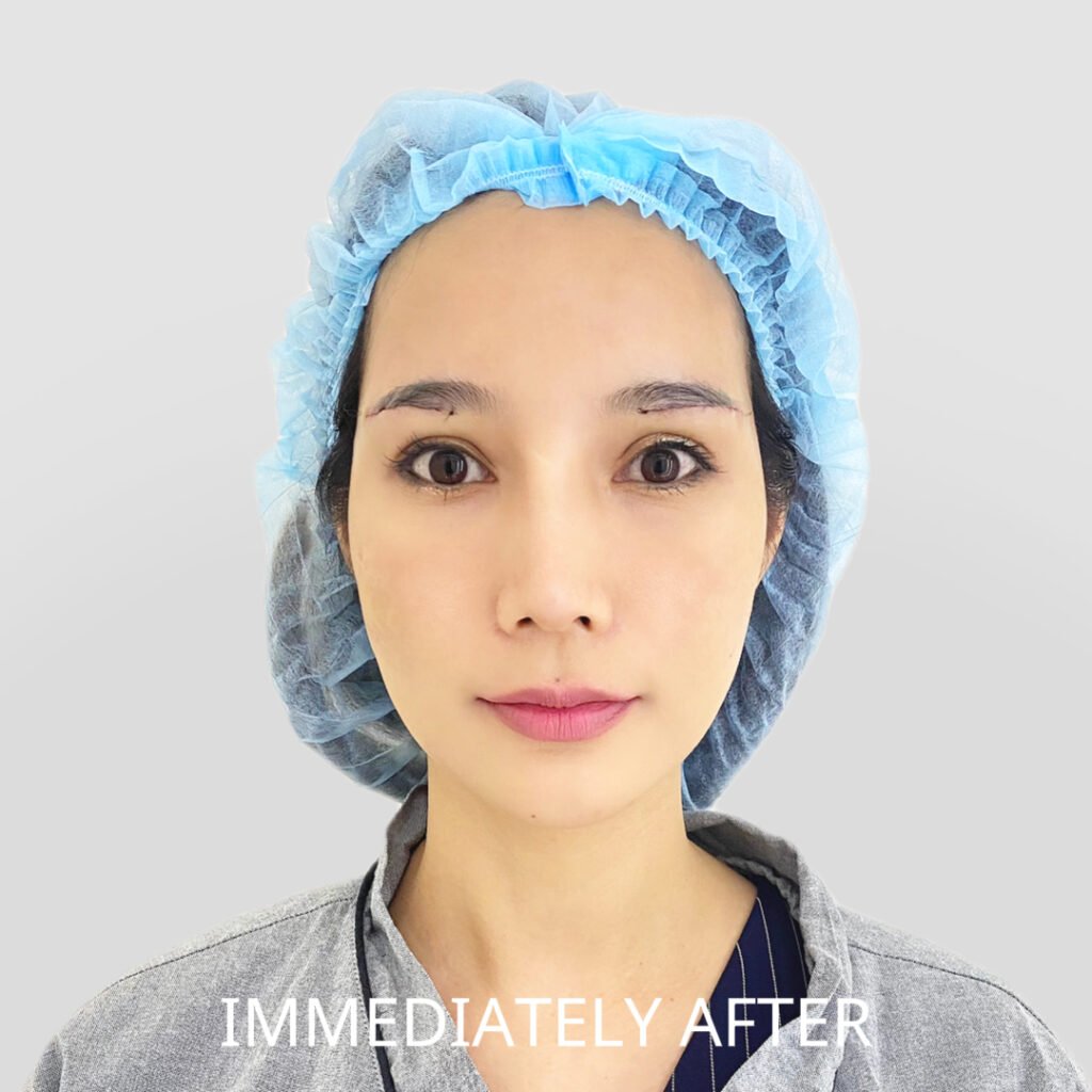 Before/After