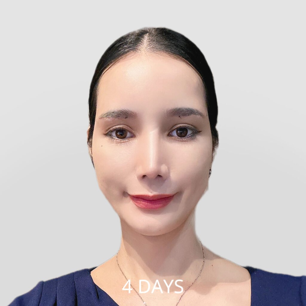 Before/After