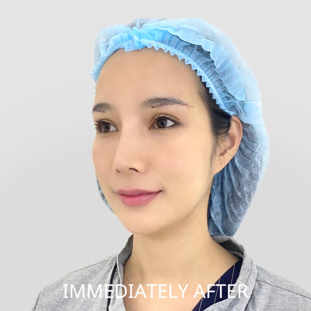 Before/After